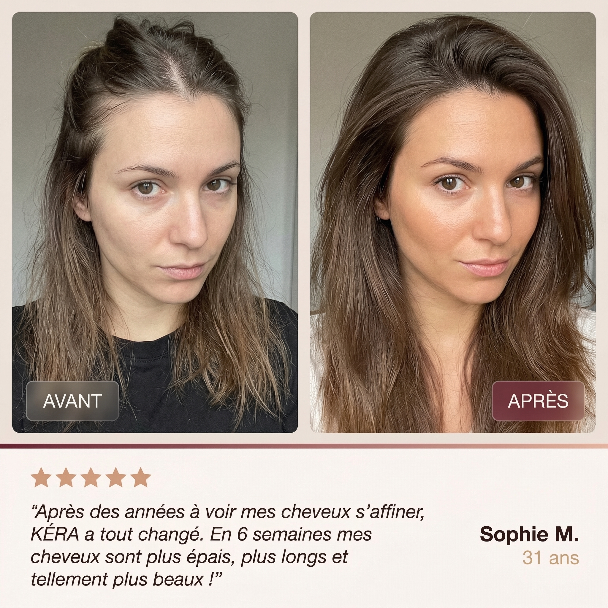 KERA HAIR GROWTH EXTRA FORT